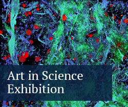 ESM Today Art in Science Exhibition