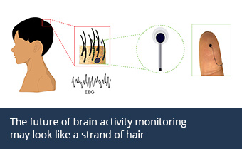 illustration of hairlike electrode for EEG monitoring