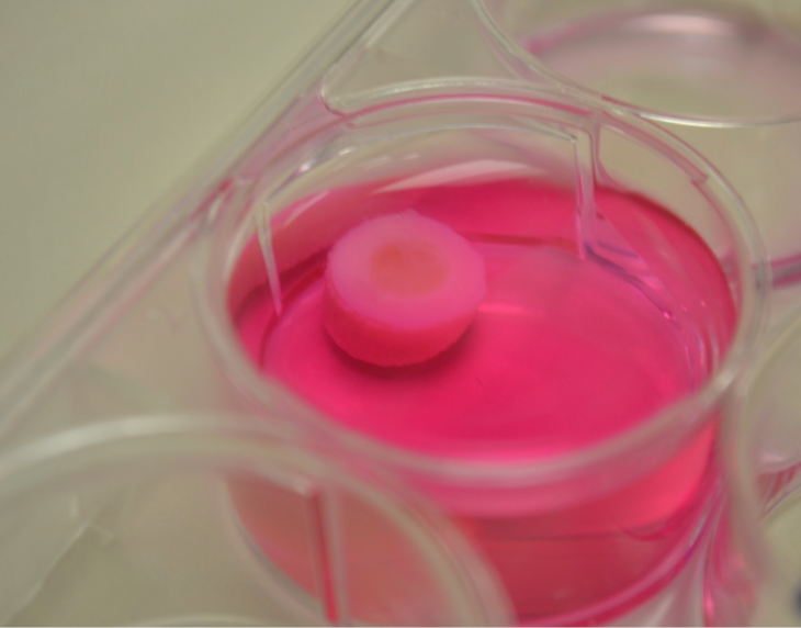 A piece of printed cartilage on a plug of bone in a petri dish of nutrient media.